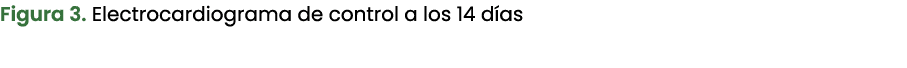 Figura 3. Electrocardiograma de control a los 14 d as 