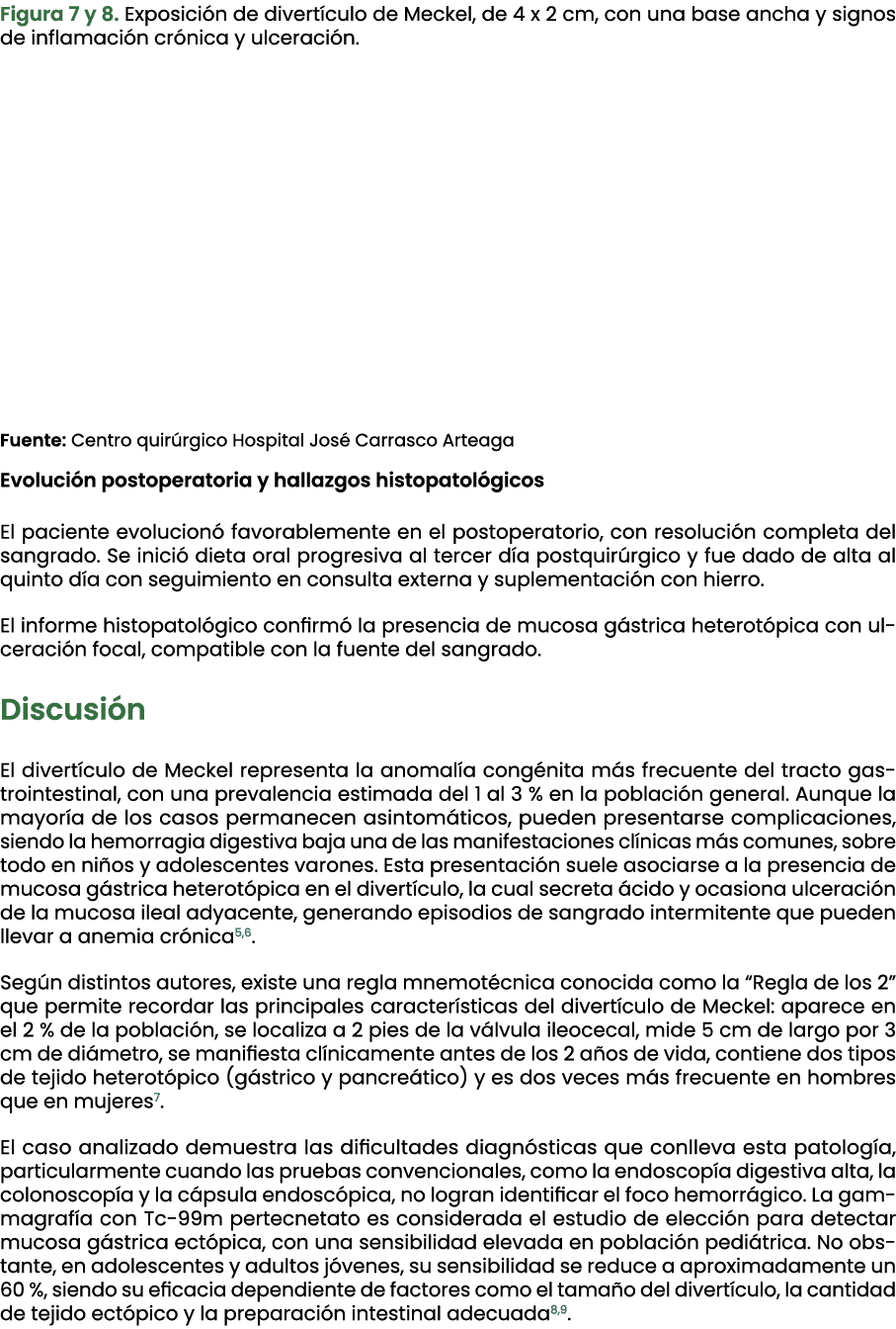Figura 7 y 8. Exposici n de divert culo de Meckel, de 4 x 2 cm, con una base ancha y signos de inflamaci n cr nica y ...