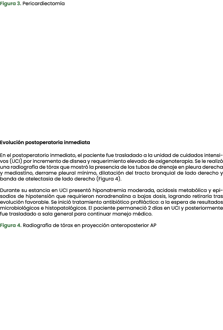 Figura 3. Pericardiectom a Evoluci n postoperatoria inmediata En el postoperatorio inmediato, el paciente fue traslad...